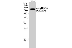 Western Blot analysis of K562 cells using Acetyl-HSP 90 (K292/284) Polyclonal Antibody. (HSP90 Antikörper  (acLys284, acLys292))