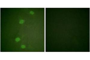 Immunofluorescence analysis of HeLa cells, using Retinoblastoma (Phospho-Ser249) Antibody. (Retinoblastoma Protein (Rb) Antikörper  (pSer249))