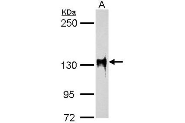 SF3B3 Antikörper  (C-Term)