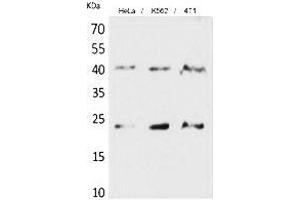 Western Blot analysis of hela, K562, 4T1 cells using TMEM173 Polyclonal Antibody. (STING/TMEM173 Antikörper  (C-Term))