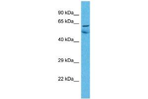 Host:  Rabbit  Target Name:  ZNF48  Sample Type:  Lung Tumor lysates  Antibody Dilution:  1. (ZNF48 Antikörper  (C-Term))