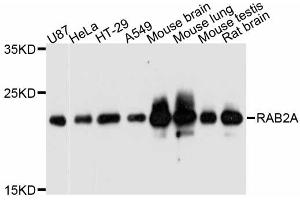 Western blot analysis of extracts of various cell lines, using RAB2A antibody (ABIN5998650) at 1:3000 dilution. (RAB2A Antikörper)