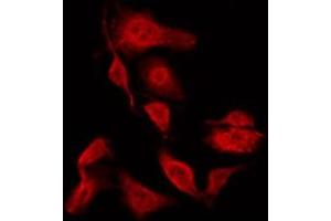 ABIN6267294 staining HeLa by IF/ICC. (HSP27 Antikörper  (pSer15))