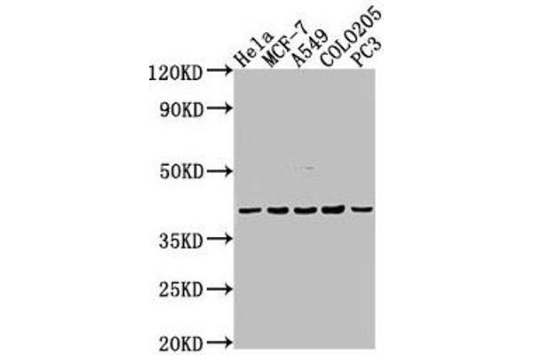 EDG4 Antikörper  (AA 8-27)