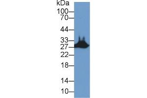 Detection of STC2 in Mouse Skeletal muscle lysate using Polyclonal Antibody to Stanniocalcin 2 (STC2) (Stanniocalcin 2 Antikörper  (AA 53-294))