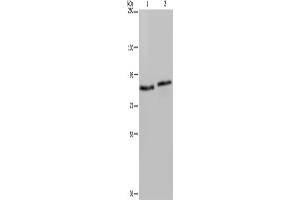 Western Blotting (WB) image for anti-Integrin beta 2 (ITGB2) antibody (ABIN2430320) (Integrin beta 2 Antikörper)