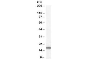 Western blot testing of human testis lysate with STMN1 antibody at 1ug/ml. (Stathmin 1 Antikörper)