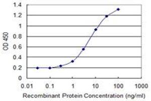 Detection limit for recombinant GST tagged CENPJ is 0. (CENPJ Antikörper  (AA 979-1088))