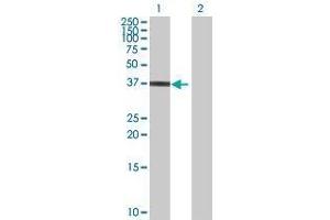 Lane 1: HAPLN3 transfected lysate ( 39. (HAPLN3 293T Cell Transient Overexpression Lysate(Denatured))