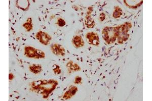 Immunohistochemistry (IHC) image for anti-Ataxia Telangiectasia Mutated (ATM) antibody (ABIN7127350)