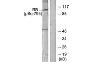 Western Blotting (WB) image for anti-Retinoblastoma Protein (Rb Protein) (pSer795) antibody (ABIN2888520) (Retinoblastoma Protein (Rb) Antikörper  (pSer795))