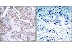 Immunohistochemistry (IHC) image for anti-Tumor Protein P53 (TP53) (pSer15) antibody (ABIN2888497) (p53 Antikörper  (pSer15))