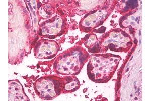 Anti-Luteinizing Hormone antibody IHC of human placenta. (Luteinizing Hormone Antikörper)