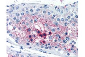 Anti-CTSL2 / Cathepsin V antibody IHC of human testis. (Cathepsin L2 Antikörper)