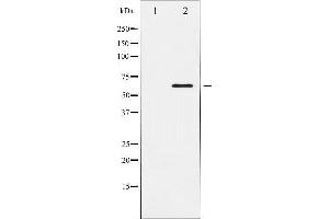 Western Blotting (WB) image for anti-ELK1, Member of ETS Oncogene Family (ELK1) antibody (ABIN1846330) (ELK1 Antikörper)