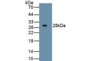 Detection of Recombinant PDGFRa, Human using Monoclonal Antibody to Platelet Derived Growth Factor Receptor Alpha (PDGFRa) (PDGFRA Antikörper  (AA 170-387))