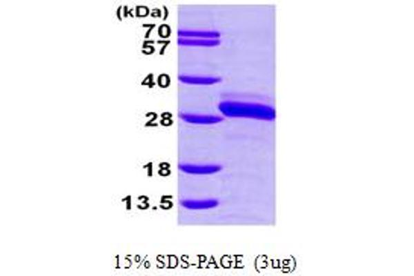 rala Protein (AA 1-203) (His tag)