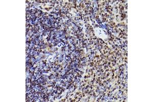 Immunohistochemistry of paraffin-embedded mouse spleen using MEF2A+MEF2C Rabbit mAb (ABIN1679049, ABIN1679050, ABIN7101495 and ABIN7101496) at dilution of 1:100 (40x lens). (MEF2A+MEF2C Antikörper)