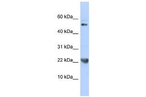 TNFSF12 antibody used at 1 ug/ml to detect target protein. (TWEAK Antikörper)