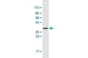 Western Blot detection against Immunogen (36. (Recoverin Antikörper  (AA 3-99))