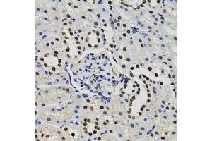 Immunohistochemistry of paraffin-embedded rat kidney using GTF2I antibody (ABIN5995399) (40x lens). (GTF2I Antikörper)