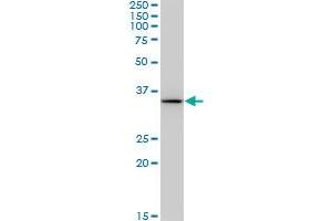 BDH1 monoclonal antibody (M03), clone 4B3. (BDH1 Antikörper  (AA 1-343))