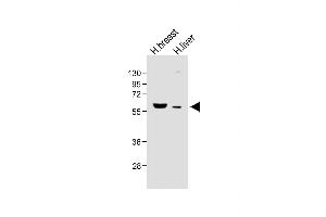 Western Blotting (WB) image for anti-Fatty Acid Desaturase 2 (FADS2) (AA 79-108), (N-Term) antibody (ABIN656230)