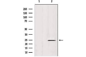 Western blot analysis of extracts from rat spleen, using IFT25 antibody. (HSPB11 Antikörper  (N-Term))