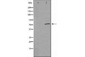 Western blot analysis of extracts from 293 cell, using GSDMC antibody. (MLZE Antikörper  (Internal Region))