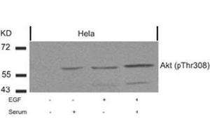 Image no. 2 for anti-V-Akt Murine Thymoma Viral Oncogene Homolog 1 (AKT1) (pThr308) antibody (ABIN196711) (AKT1 Antikörper  (pThr308))