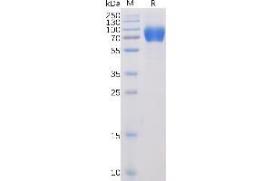 Human SL Protein, mFc-His Tag on SDS-PAGE under reducing condition. (SLAMF1 Protein (AA 21-231) (mFc-His Tag))