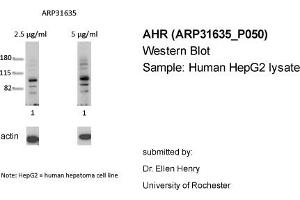Western Blotting (WB) image for anti-Aryl Hydrocarbon Receptor (AHR) (N-Term) antibody (ABIN182389) (Aryl Hydrocarbon Receptor Antikörper  (N-Term))