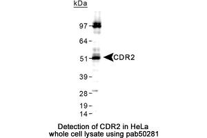 Image no. 2 for anti-Cerebellar Degeneration-Related Protein 2, 62kDa (CDR2) (C-Term) antibody (ABIN363590) (CDR2 Antikörper  (C-Term))