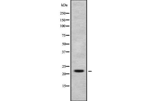 H1FX Antikörper  (N-Term)