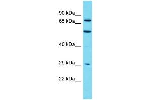 Host: Rabbit Target Name: MTMR7 Sample Type: HT1080 Whole Cell lysates Antibody Dilution: 1. (MTMR7 Antikörper  (C-Term))