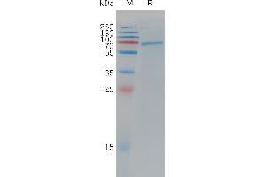 Cynomolgus A Protein, His Tag on SDS-PAGE under reducing condition. (ADAM9 Protein (AA 29-698) (His tag))