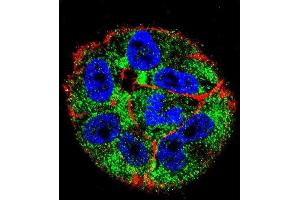 Confocal immunofluorescent analysis of p53 Antibody (S15) (ABIN390201 and ABIN2840688) with  cell followed by Alexa Fluor 488-conjugated goat anti-rabbit lgG (green). (p53 Antikörper  (AA 1-30))