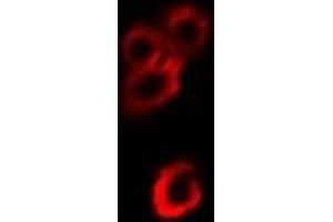 Immunofluorescent analysis of Alpha-enolase staining in Hela cells. (ENO1 Antikörper)