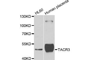 Western blot analysis of extracts of various cell lines, using TACR3 antibody (ABIN5975101) at 1/1000 dilution. (TACR3 Antikörper)