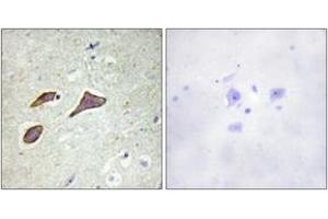 Immunohistochemistry analysis of paraffin-embedded human brain, using Nonvoltage-gated Sodium Channel 1 (Phospho-Thr615) Antibody. (Nonvoltage-Gated Sodium Channel 1 (AA 581-630), (pThr615) Antikörper)