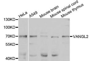 Western blot analysis of extracts of various cell lines, using VANGL2 antibody (ABIN5975655) at 1/1000 dilution. (VANGL2 Antikörper)