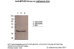 Image no. 2 for anti-Microtubule Associated Tumor Suppressor 1 (MTUS1) (N-Term) antibody (ABIN310597) (MTUS1 Antikörper  (N-Term))