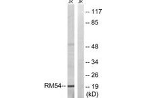 Western blot analysis of extracts from Jurkat cells, using MRPL54 Antibody. (MRPL54 Antikörper  (AA 81-130))