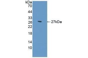 Detection of Recombinant CDH2, Human using Polyclonal Antibody to N-cadherin (NCAD) (N-Cadherin Antikörper  (AA 50-276))