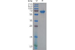 Human Protein, hFc Tag on SDS-PAGE under reducing condition. (NCR1 Protein (AA 22-254) (Fc Tag))