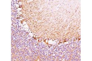 IHC testing of cerebellum stained with Neurofilament Heavy antibody (RT97). (NEFH Antikörper)