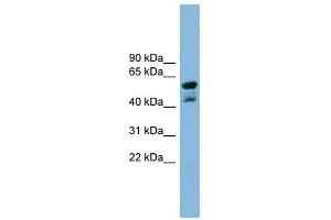 PPME1 antibody used at 1 ug/ml to detect target protein. (PPME1 Antikörper  (N-Term))