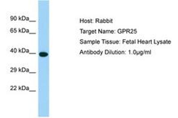 GPR25 Antikörper  (C-Term)