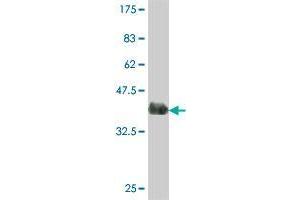 Western Blot detection against Immunogen (37. (MLKL Antikörper  (AA 371-471))