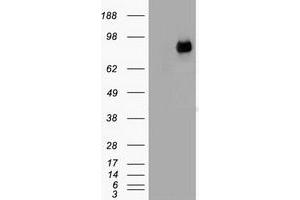 HEK293T cells were transfected with the pCMV6-ENTRY control (Left lane) or pCMV6-ENTRY CTNNB1 (Right lane) cDNA for 48 hrs and lysed. (CTNNB1 Antikörper  (AA 531-781))